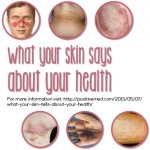 What Your Skin Tells about Your Health